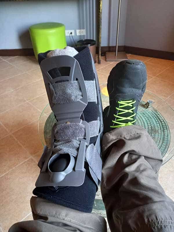 ankle-injury-thailand-Michael Parrotte